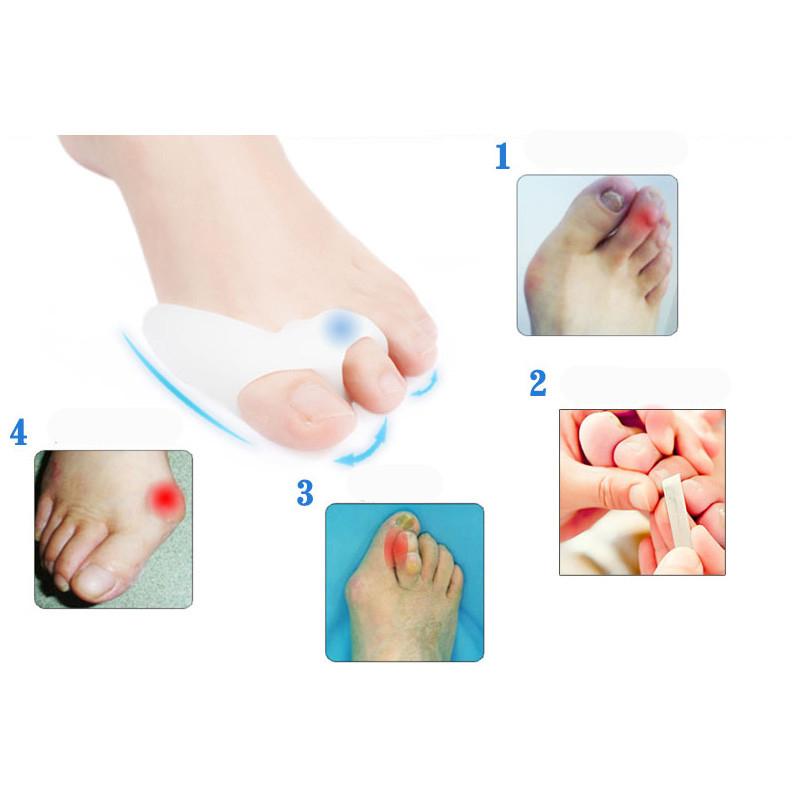 4pcs Orthopedic Silicone Big Toe Separator Bunion Corrector Double R