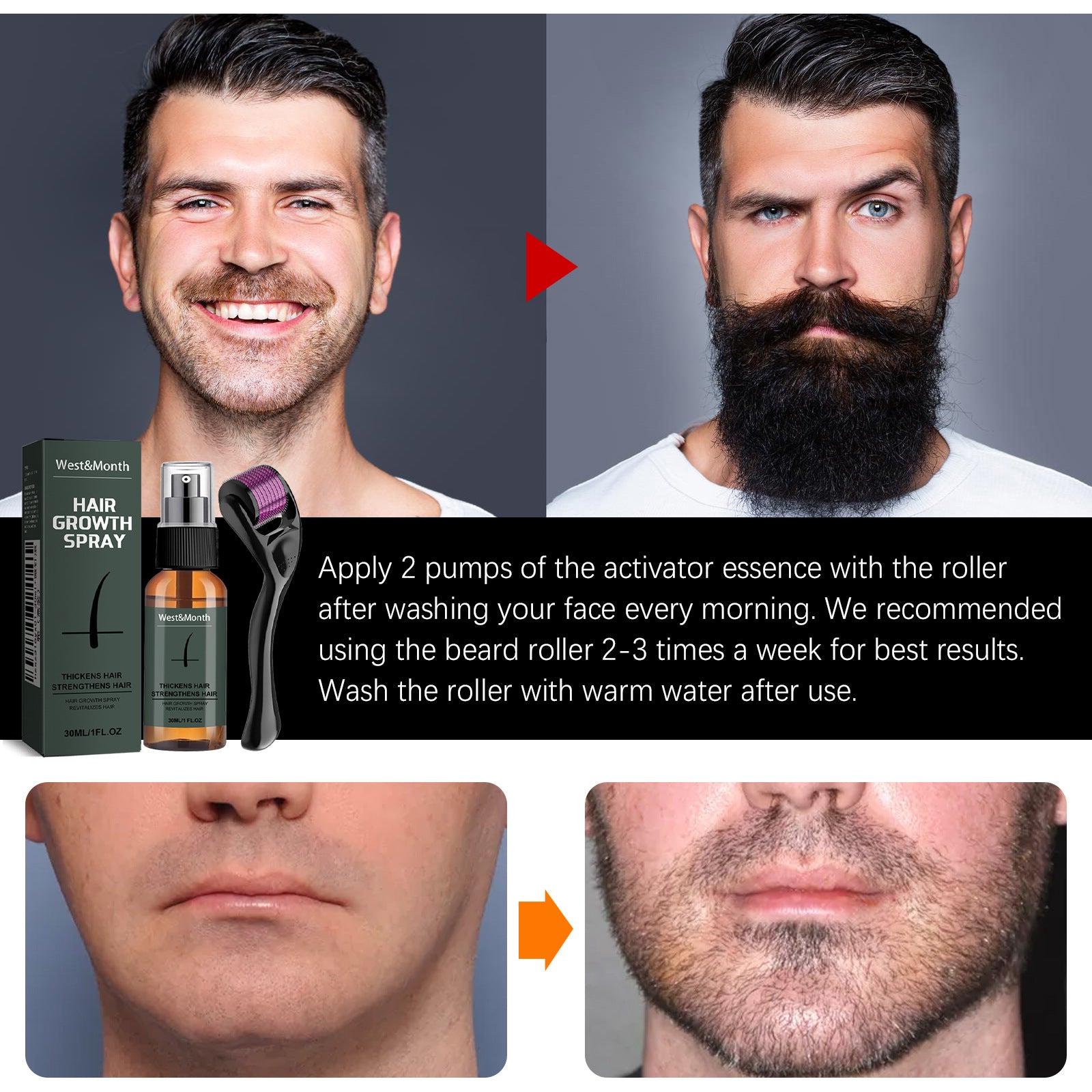 West&Month Beard Growth Spray 30ml with Beard Roller Beard Care Kit