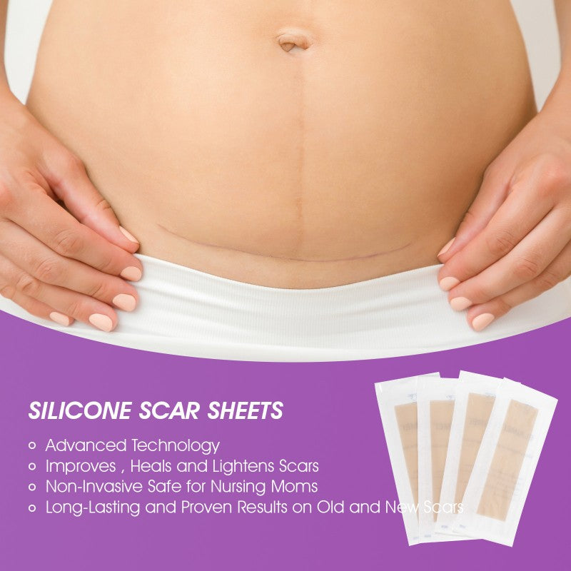4PCS Reusable Scar Removal Patch Silicone Gel Strips Patch Silicone Scar Sheet