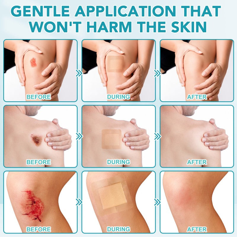 Silicone Foam Dressing Ag Sterile Wound Bandage with Waterproof Gentle Adhesive Border