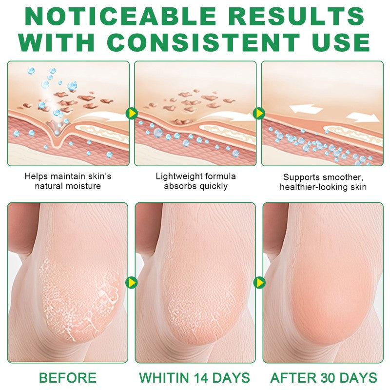 Aloe Vera Urea 60% Foot Balm Stick – Deep Repair for Cracked Heels