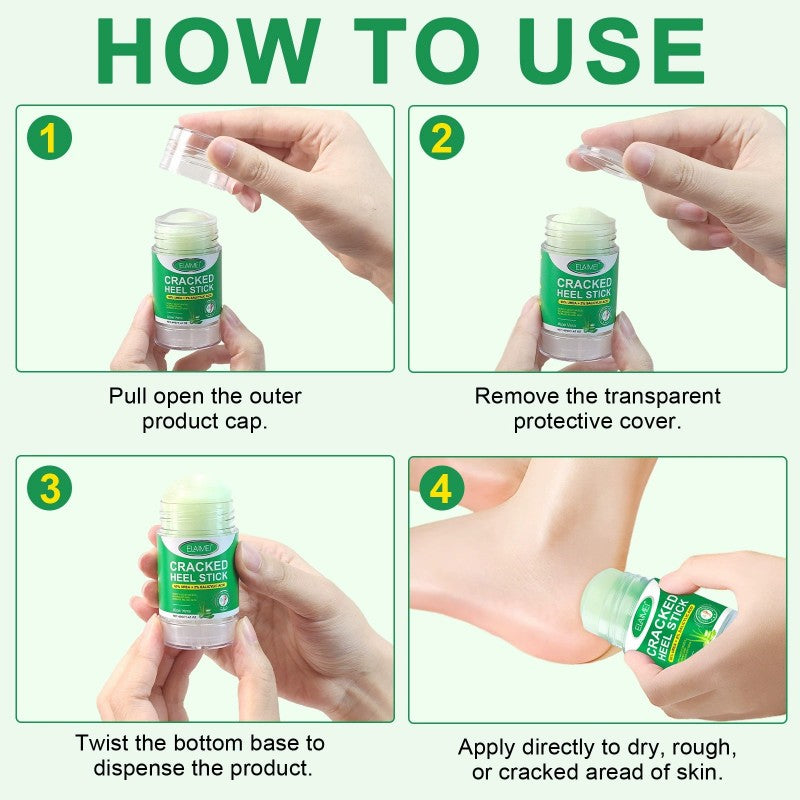 Aloe Vera Urea 60% Foot Balm Stick – Deep Repair for Cracked Heels