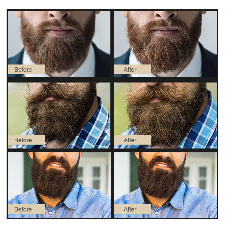 Beard Growth Oil 30ml - Stimulate Beard Growth Serum Facial Hair Treatment