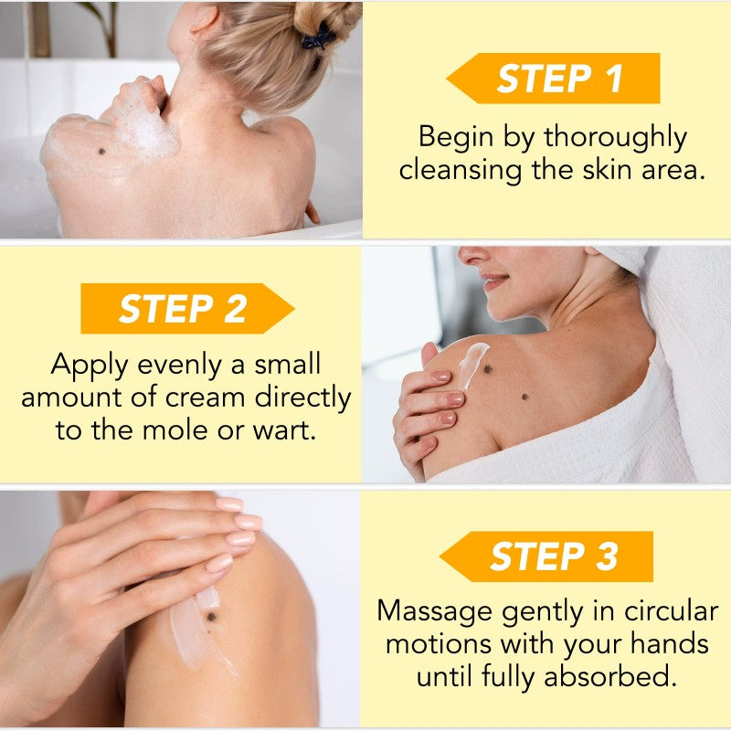 Bee Venom Cream Moles and Warts Removal Cream ﻿