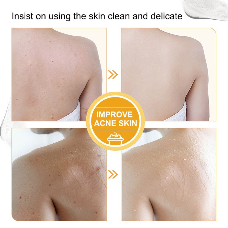 Papaya Soap – Natural Skin Brightening&Exfoliation