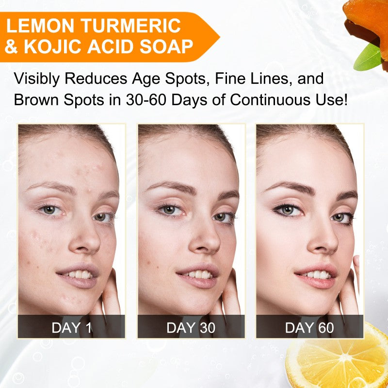 Lemon Turmeric Kojic Acid Soap Bar, Turmeric Face and Body Soap