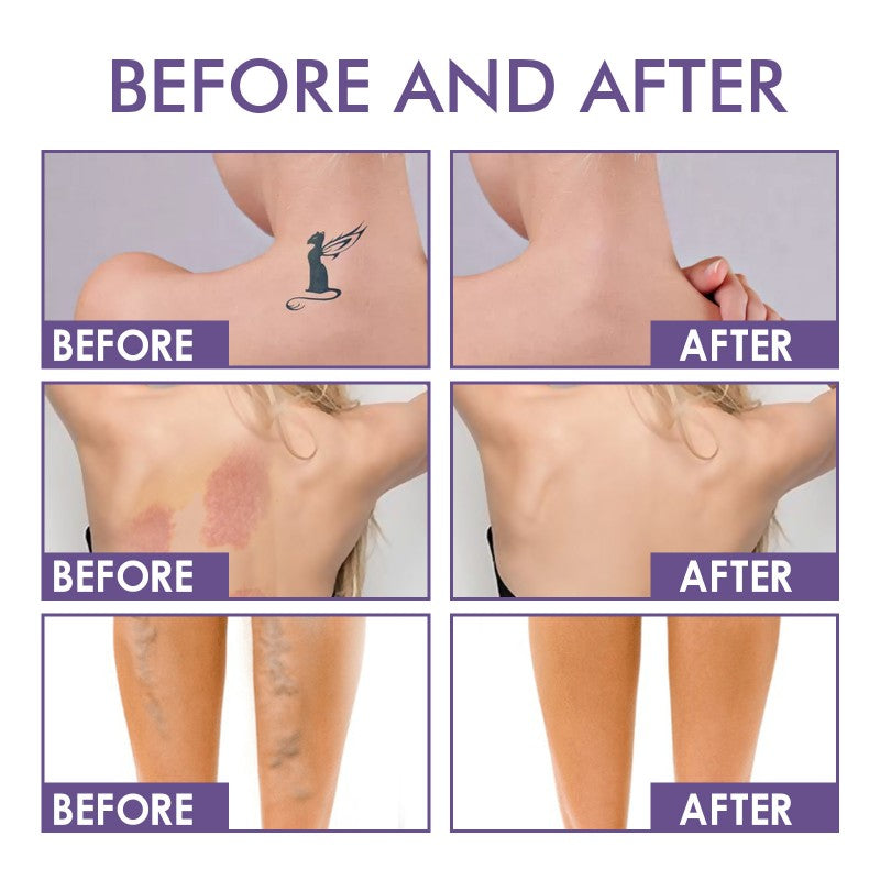 All Over Complexion Perfector Tattoo Cover Up Makeup Body Concealer