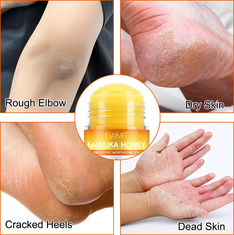 Manuka Honey Cracked Heel Treatment Balm Stick-Deep Moisturizing, Non-Greasy Foot Care