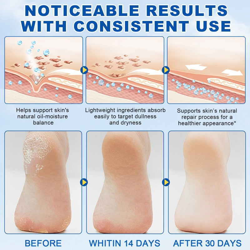 Urea Cream 60% Foot Care Stick Deeply Moisturising