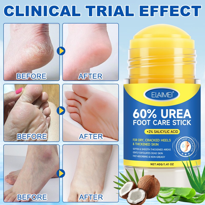 Urea Cream 60% Foot Care Stick Deeply Moisturising