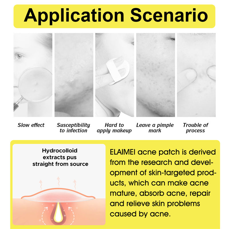 10Pcs/box Hydrocolloid Acne Patch Forehead And Cheeks Pimple Patches