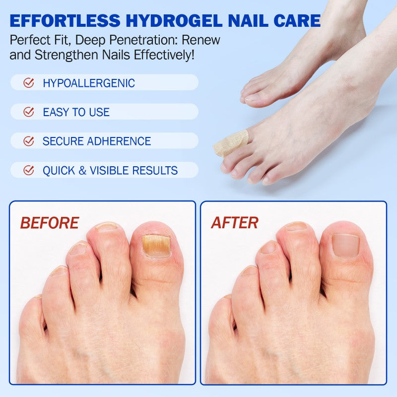 21Pcs Nail Treatment Repair Patch Toenail Pads