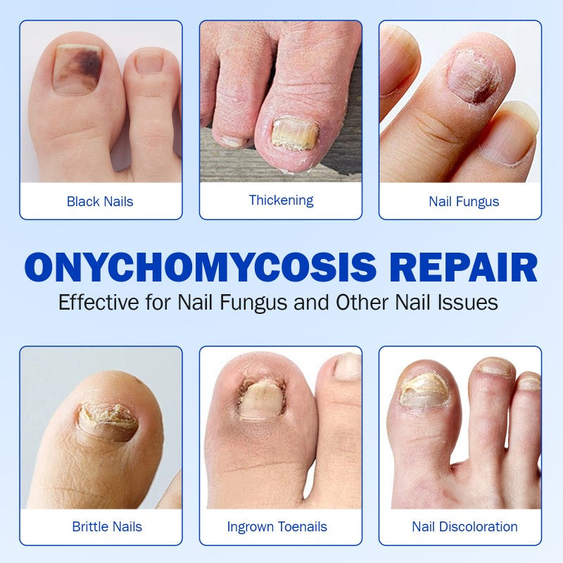 21Pcs Nail Treatment Repair Patch Toenail Pads