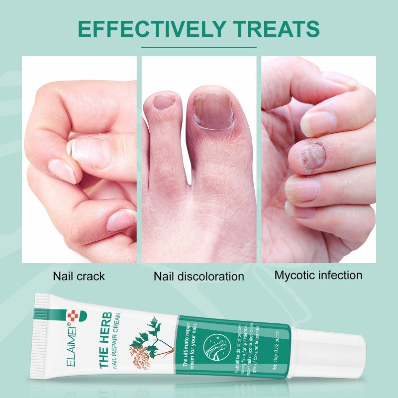 Nail Repair Cream – Deep Restoration for Damaged Fingernails & Toenails