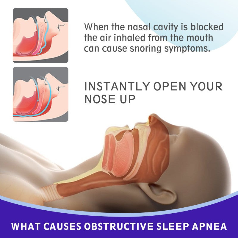 Anti-Snoring Devices Nasal-Strips for Breathing Nasal Congestion Relieve