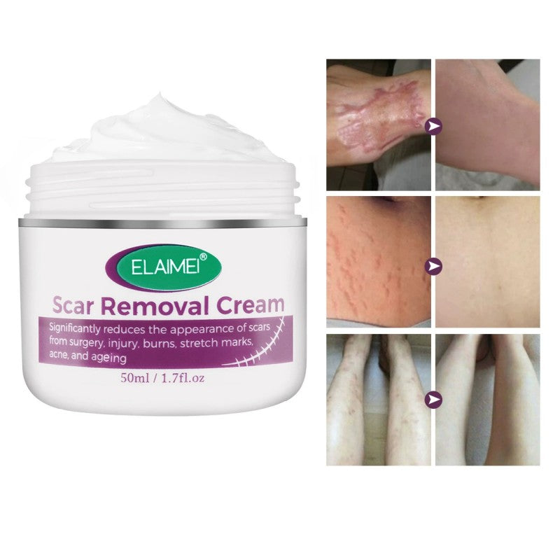 Scar Removal Cream New & Appearance of Old Scars Surgery, Stretch Marks, Acne