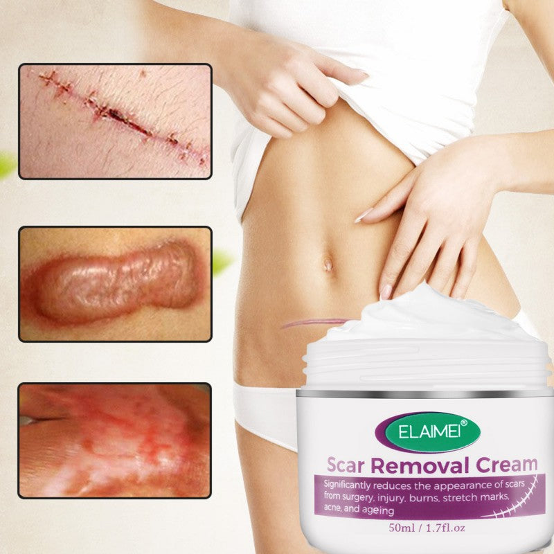 Scar Removal Cream New & Appearance of Old Scars Surgery, Stretch Marks, Acne