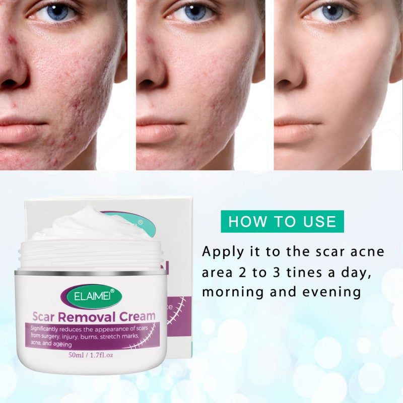 Scar Removal Cream New & Appearance of Old Scars Surgery, Stretch Marks, Acne