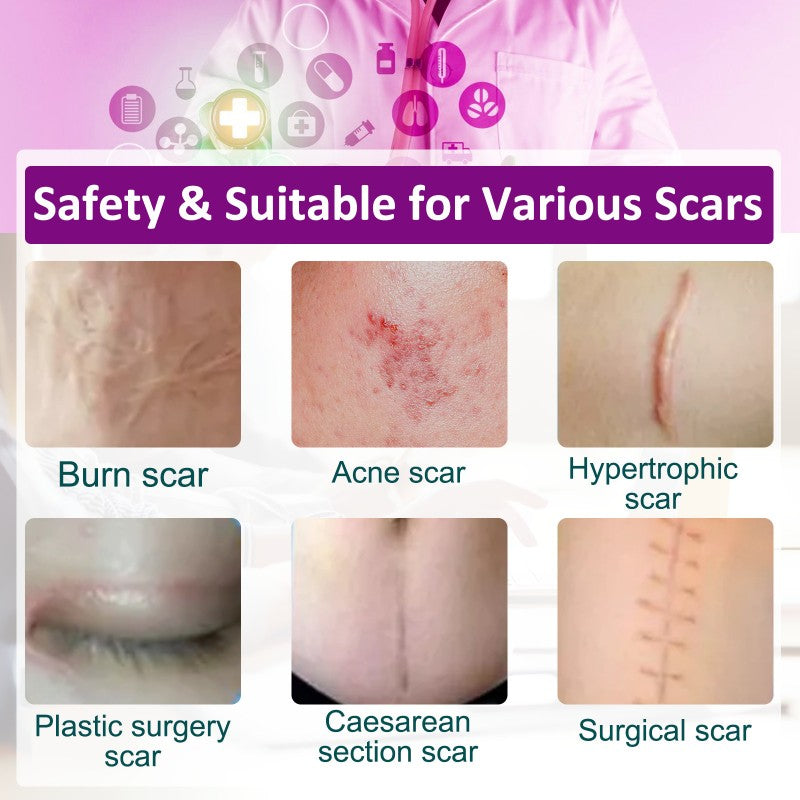 Invisible Medical Grade Scar Silicone Strips Scar Tape Patches Sheets