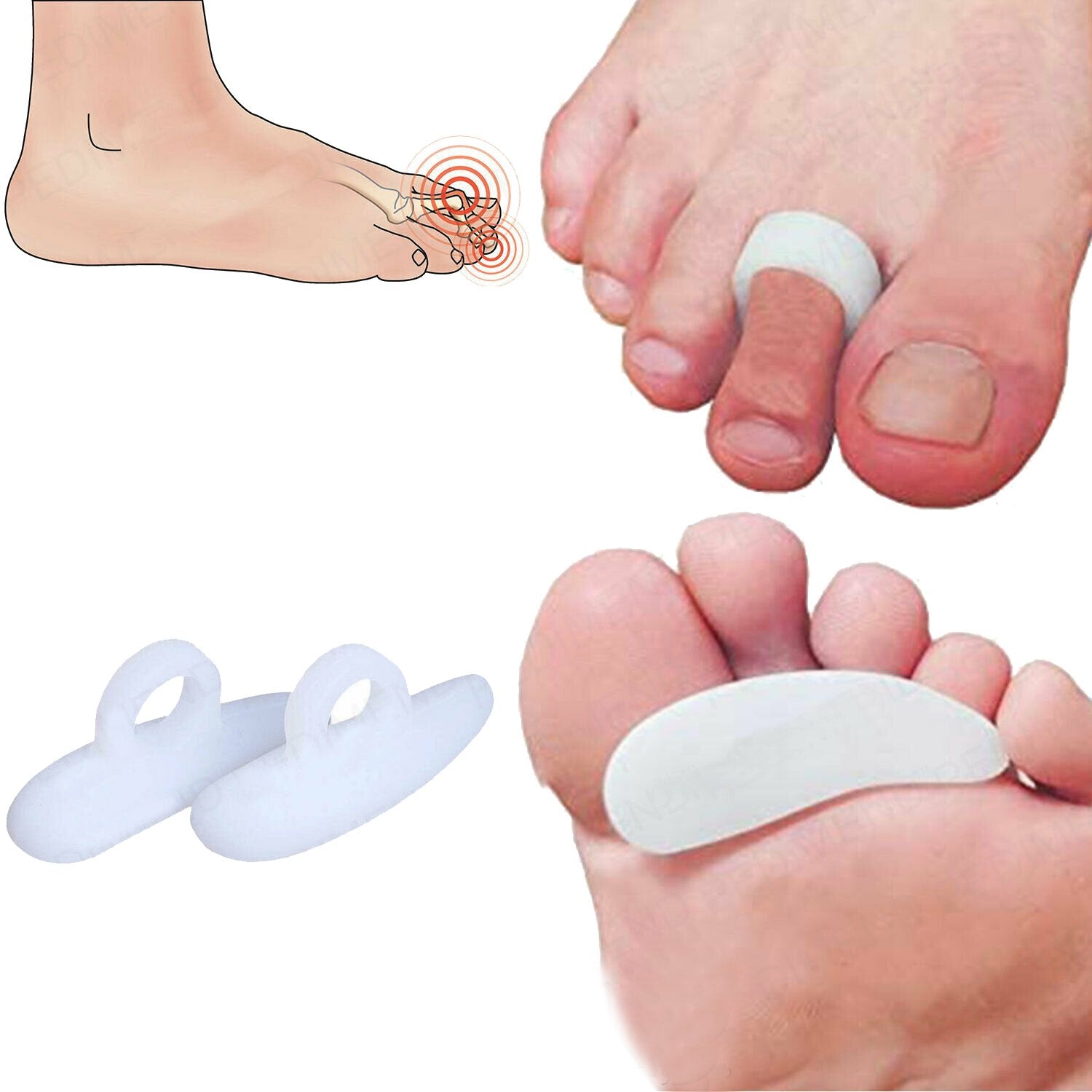 2 Pairs Feet Care Silicone Hammer Toe Separator Spacer Manicure Pedicure Tool