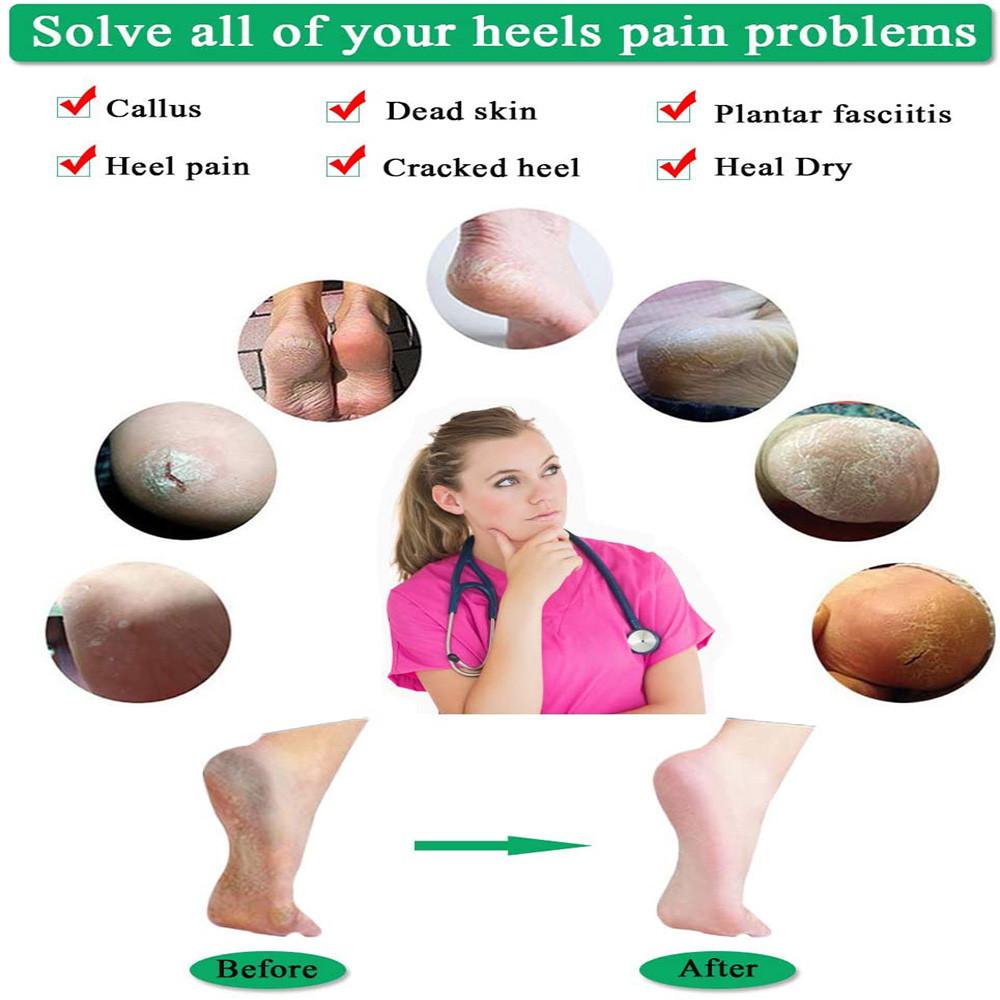 4pcs Plantar Fasciitis Heel Cushion Foot Sleeves Silicone Heel Protectors