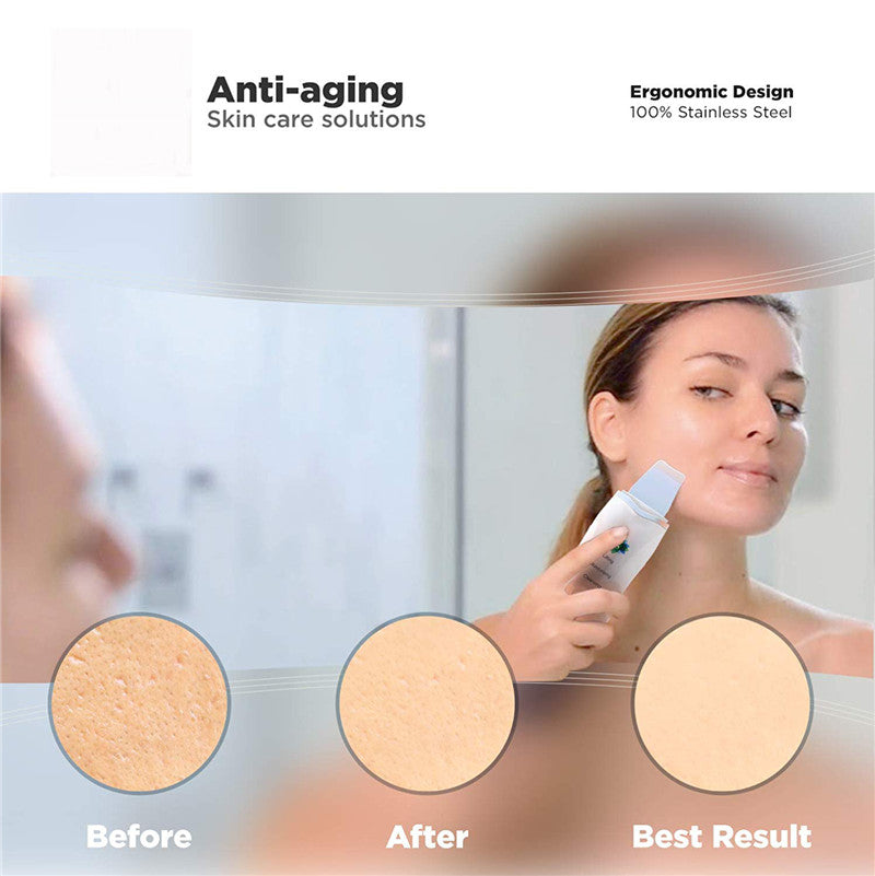 Electronial Ultrasonic Skin Scrubber Facial Pores Remover