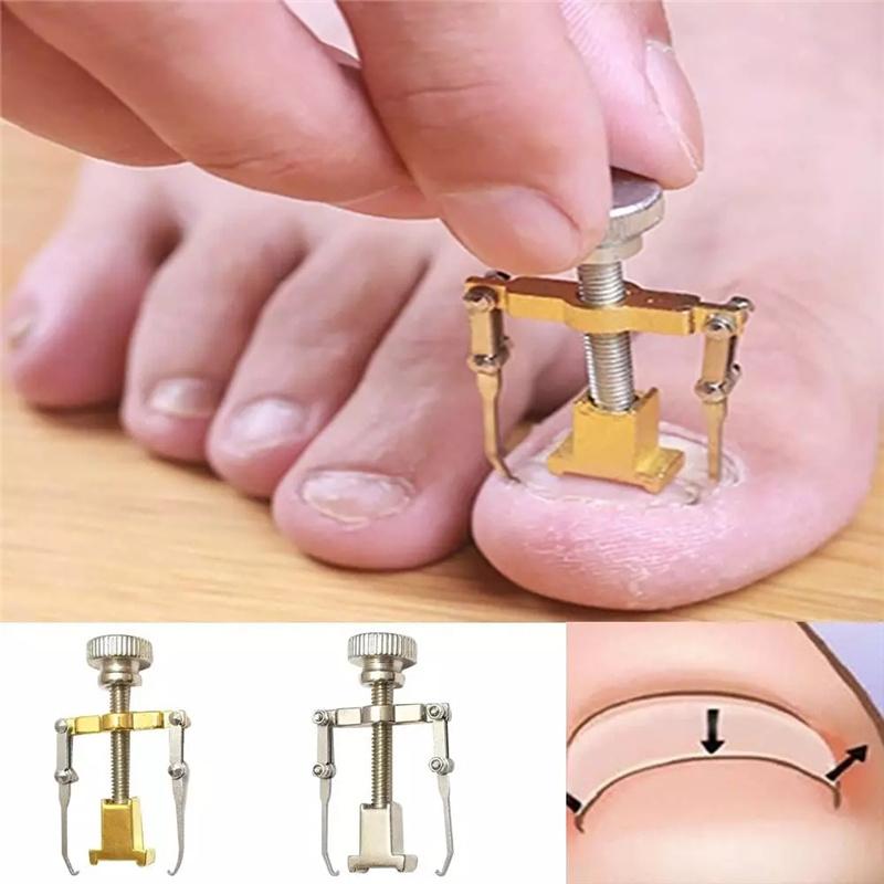 Ingrown Toenail Toe Fixer Recover Correction Device Pedicure Foot Nail Care Tool