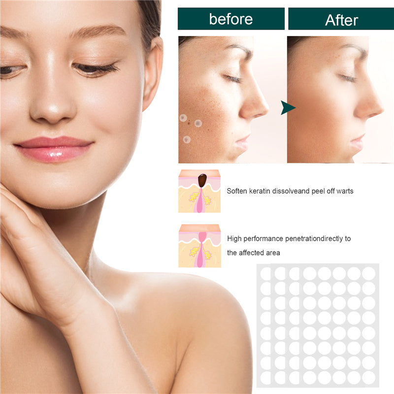 Skin Tag Removal Patches