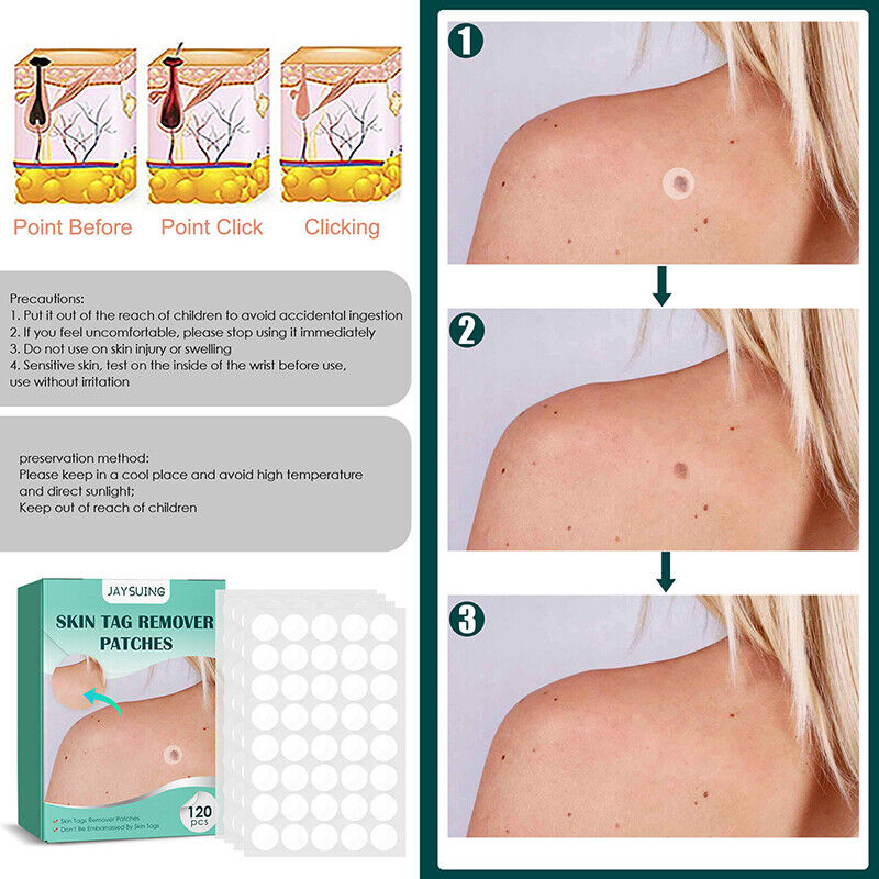 Skin Tag Removal Patches