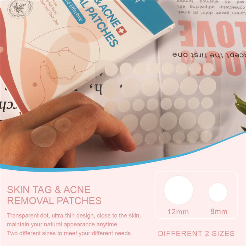 Natural Painless Auto Skin Tag Removal Kit Skin Tag Bands Remover Patches